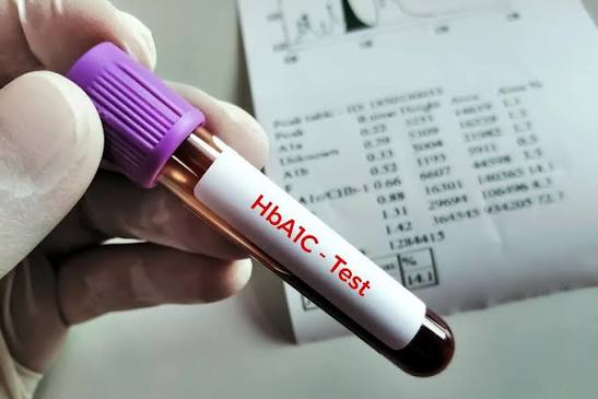 HbA1c Test